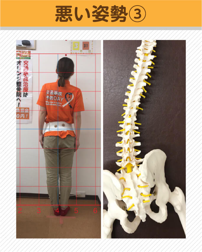 悪い姿勢3 姿勢と骨格模型の比較