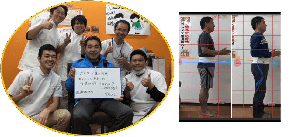 膝の痛みが改善した患者様の写真と姿勢ビフォーアフター