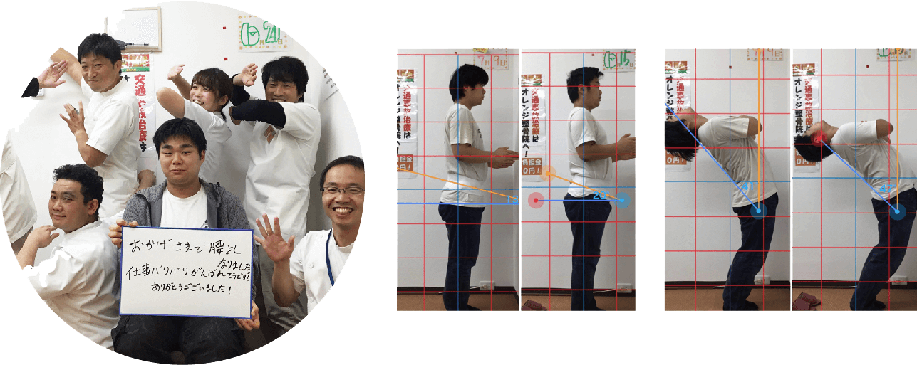 腰痛が改善した患者様の写真と姿勢ビフォーアフター