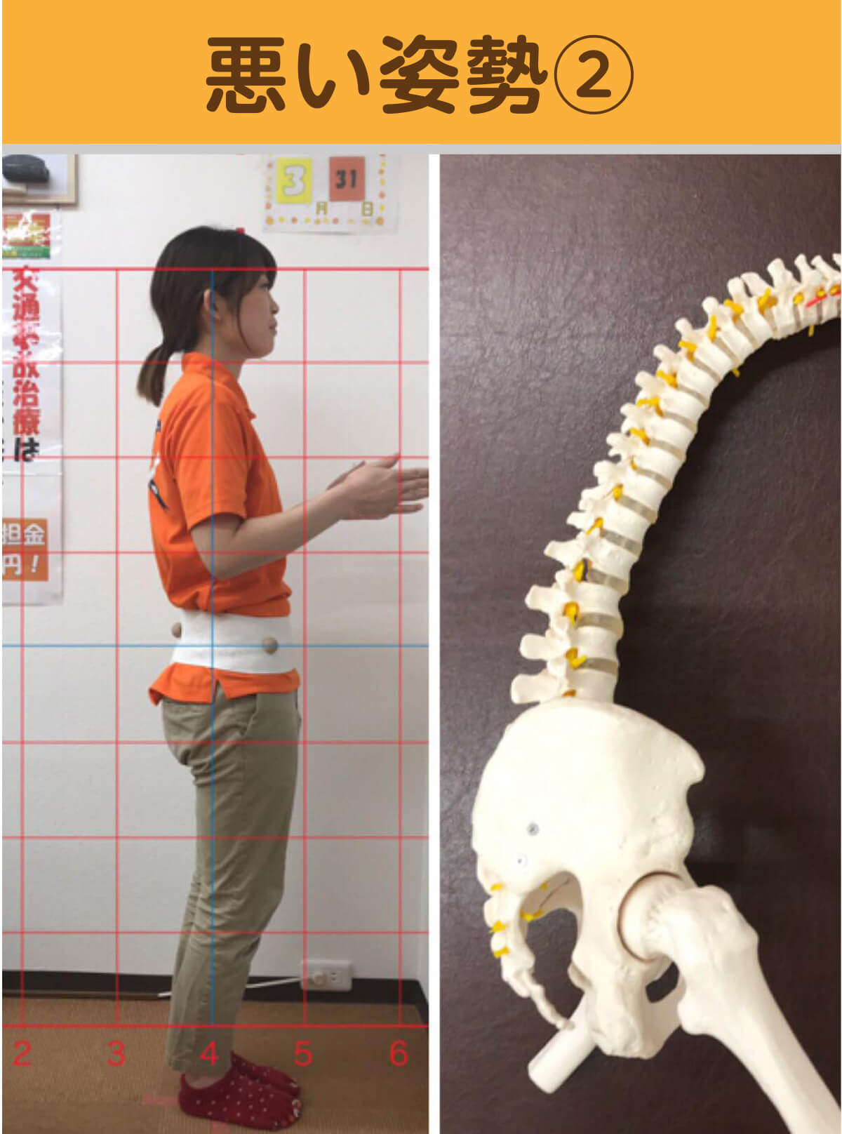 悪い姿勢2 姿勢と骨格模型の比較