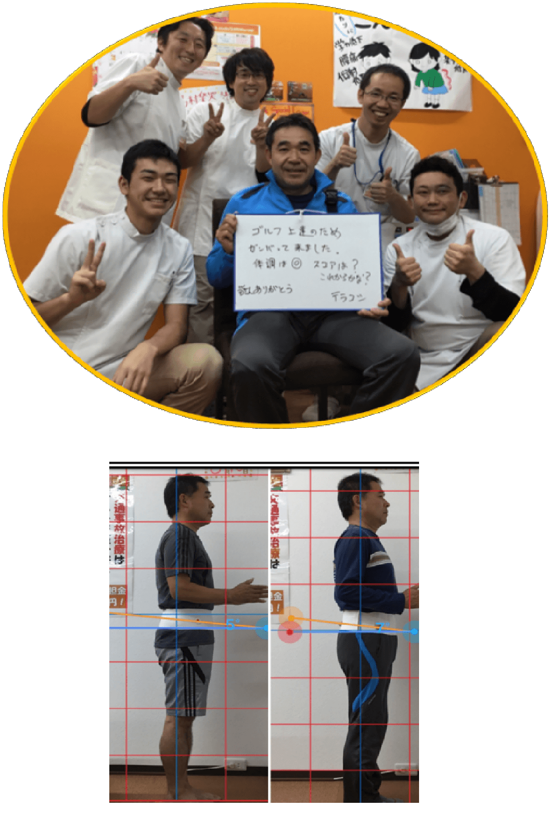 膝の痛みが改善した患者様の写真と姿勢ビフォーアフター