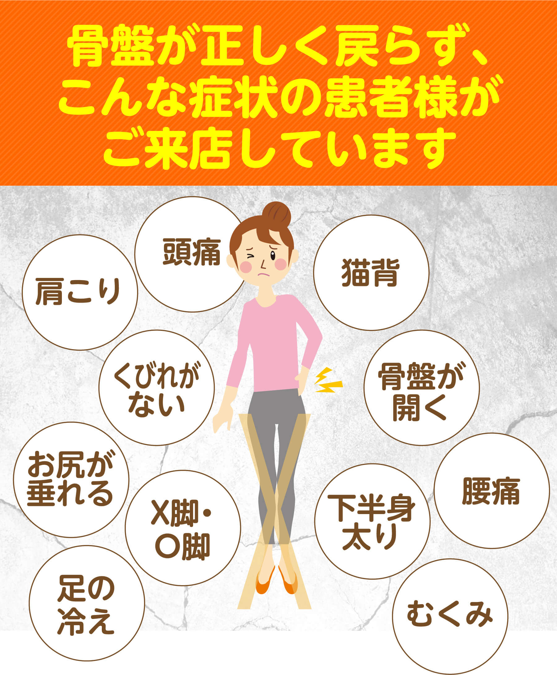 骨盤の復位不全により、以下の症状で来院される患者様が多くおられます（頭痛・肩こり・猫背・くびれがない・骨盤が開く・お尻が垂れる・X脚O脚・下半身太り・腰痛・足の冷え・むくみ）