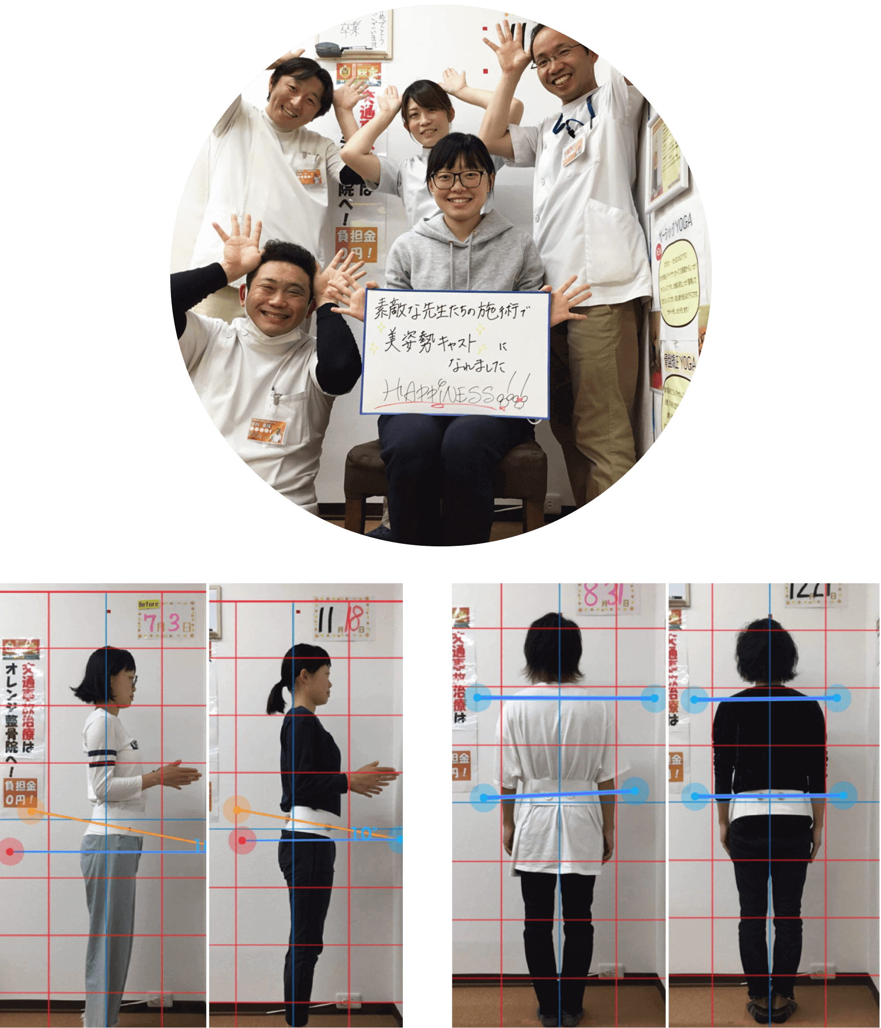 患者様の姿勢ビフォーアフターと寄せ書き写真