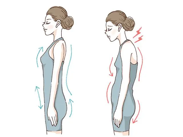 姿勢改善の様子