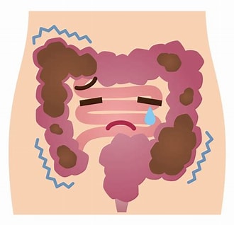 不調な腸のイラスト